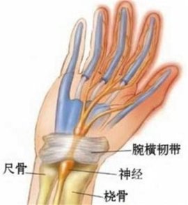 腕管综合症