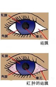 讨厌的结膜炎作文